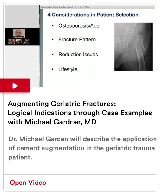 Managing Geriatric Hip Fractures Image ​