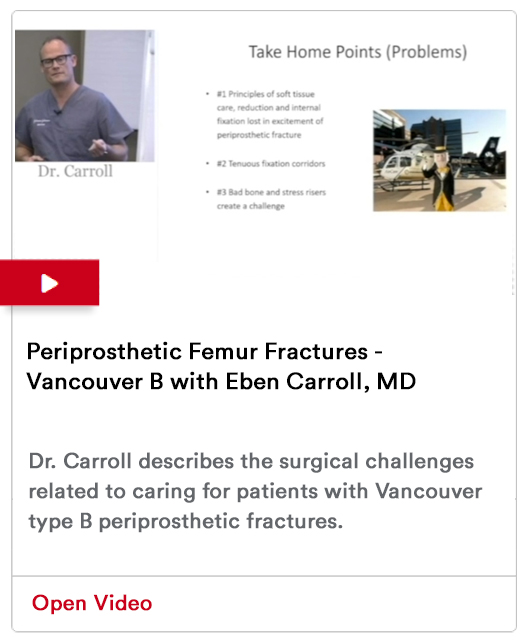 Periprosthetic Femur Fractures Image