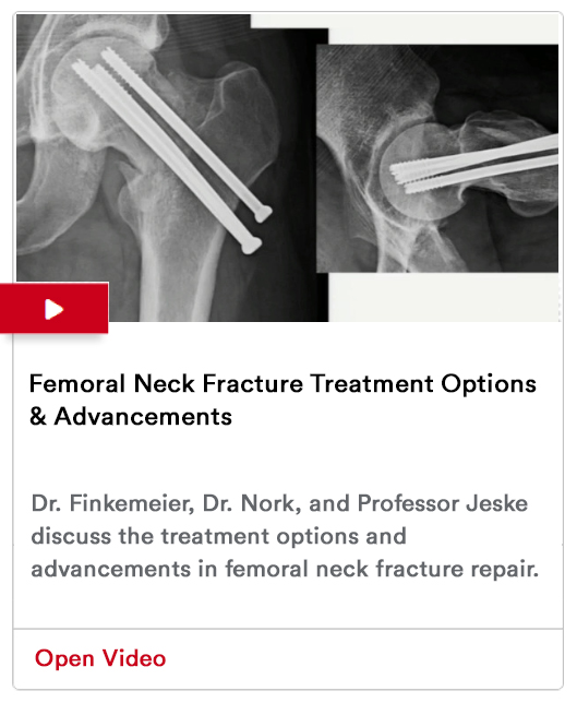 Femoral Neck Fractures Image