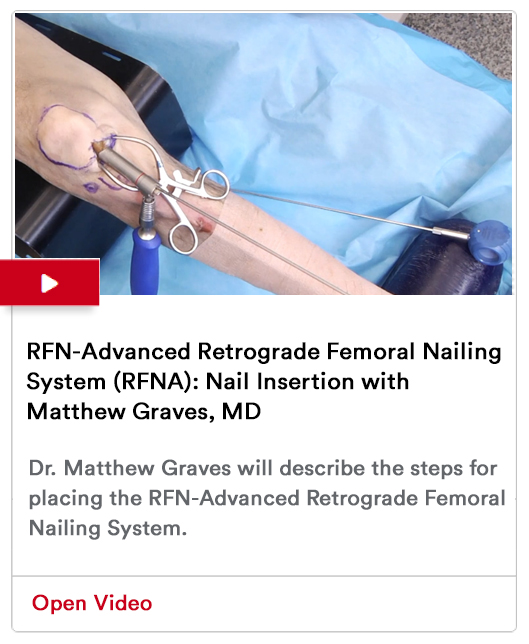 Nail Insertion Image