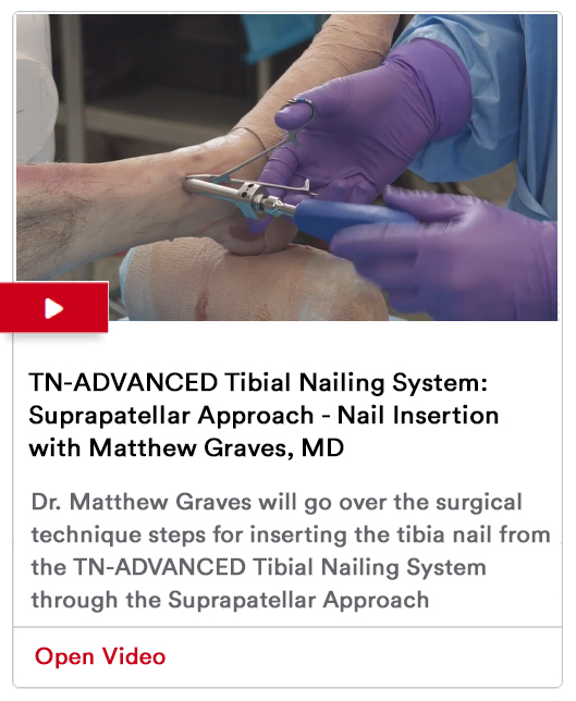 Nail Insertion Image