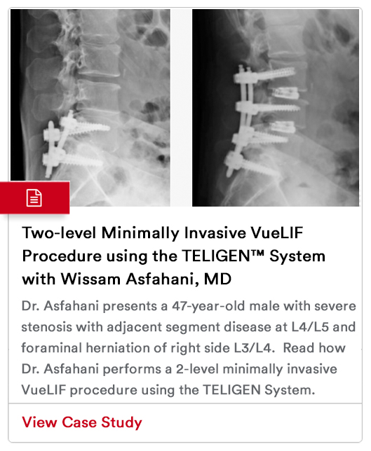 Case Study Image