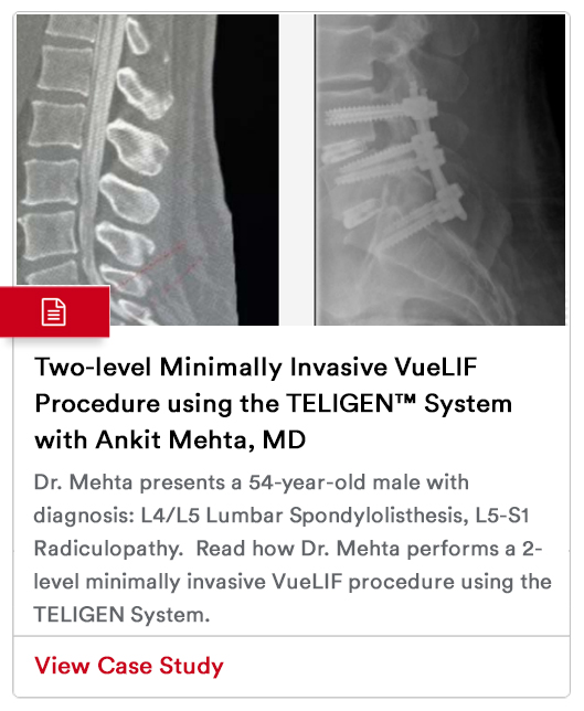 Case Study Image