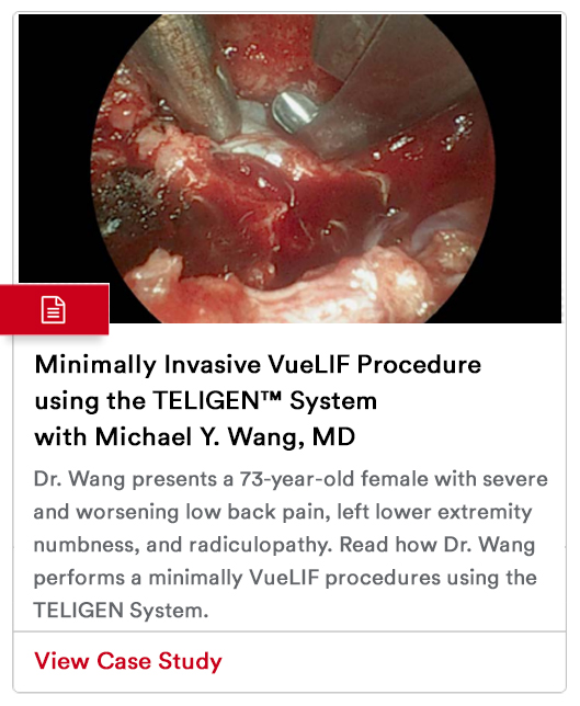 Case Study Image