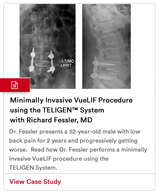 Case Study Image