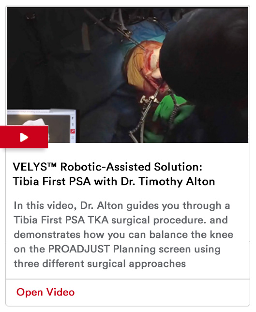 VELYS™ Robotic-Assisted Solution: Tibia First PSA with Dr. Timothy Alton Image
