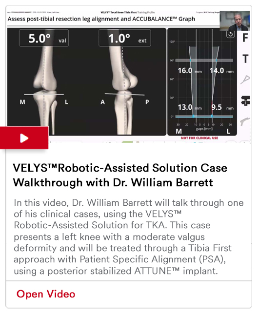 VELYS™Robotic-Assisted Solution Case Walkthrough with Dr. William Barrett Image