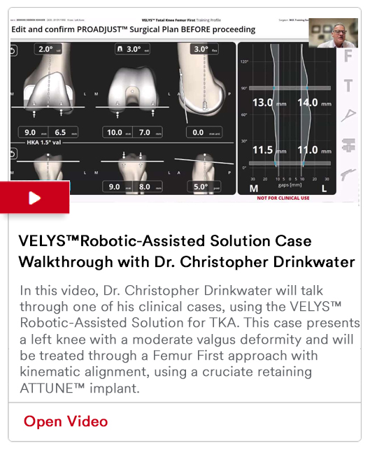 VELYS™Robotic-Assisted Solution Case Walkthrough with Dr. Christopher Drinkwater Image