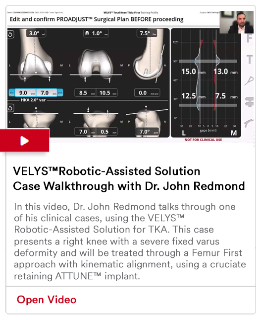 VELYS™Robotic-Assisted Solution Case Walkthrough with Dr. John Redmond Image