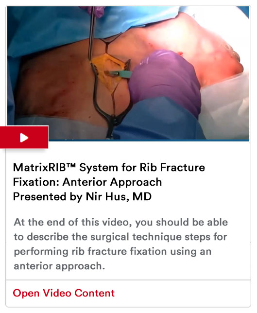 Rib Fixation Program Image