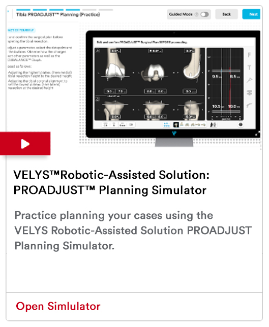 VELYS™ Robotic-Assisted Solution: PROADJUST™ Planning Simulator Image