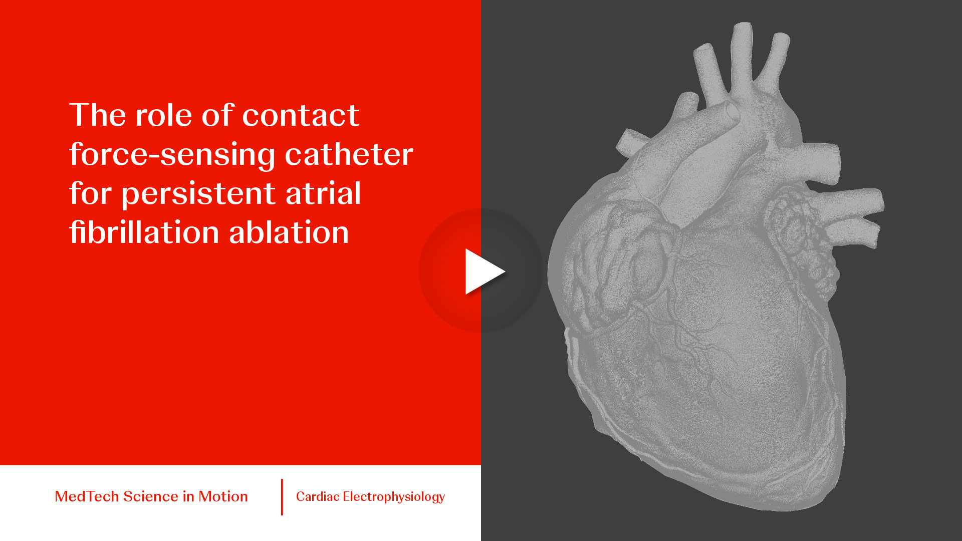 thumb he role of contact force-sensing catheter for persistent atrial fibrillation ablation